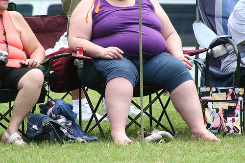 obesity females photo