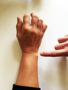 Sådan tager du mål til dit kompressionsærme ved håndleddet