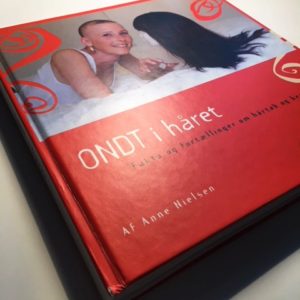 Ondt i håret er en kærlig bog om kvinder, der mister håret