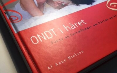 Ondt i håret er en kærlig bog om kvinder, der mister håret