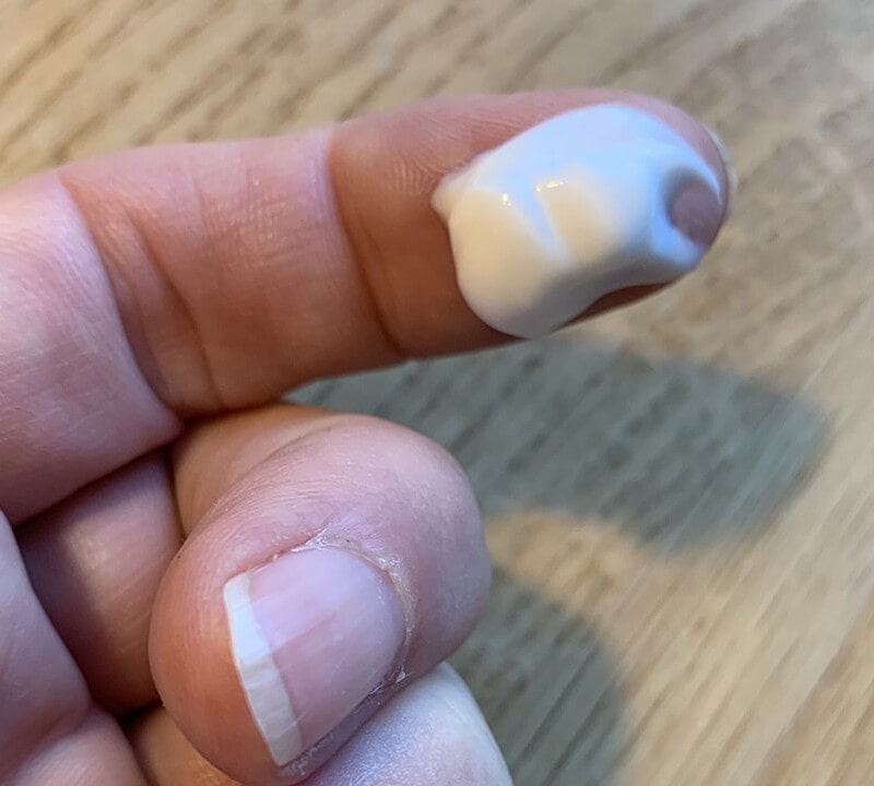 God hudpleje er alfa-omega for dig, der har lymfødem