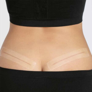 Curascar strip silikoneplaster