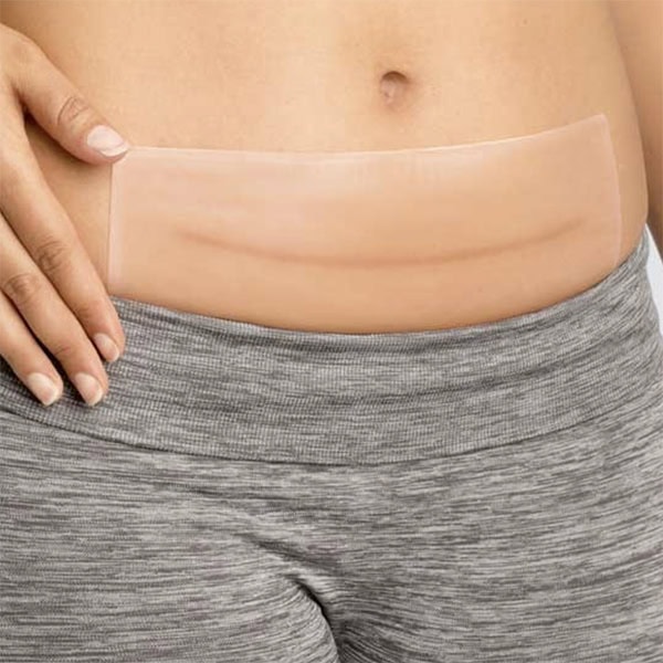 Firkantet silikoneplaster til pæn ardannelse